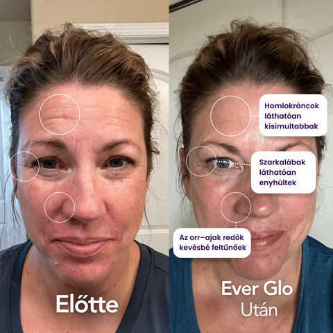 Ever Glo - Termék (Copy)