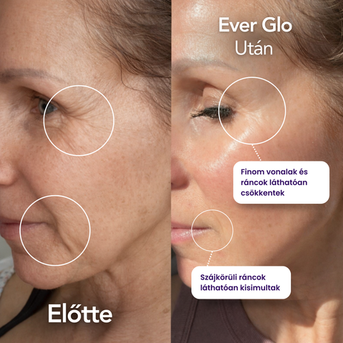Ever Glo - Termék (Copy)