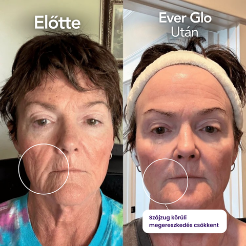 Ever Glo - Termék (Copy)